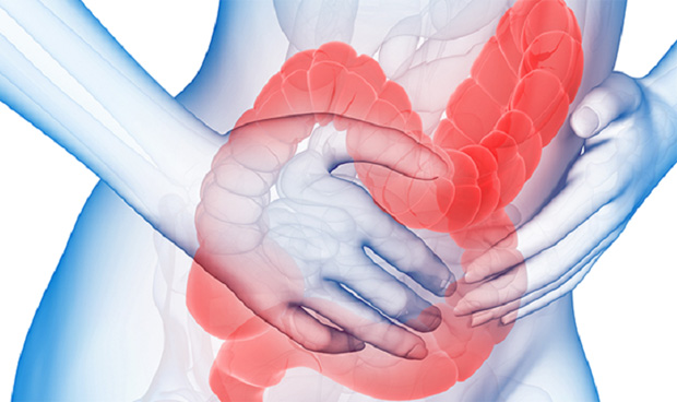Изображение человеческого тела с воспаленным кишечником